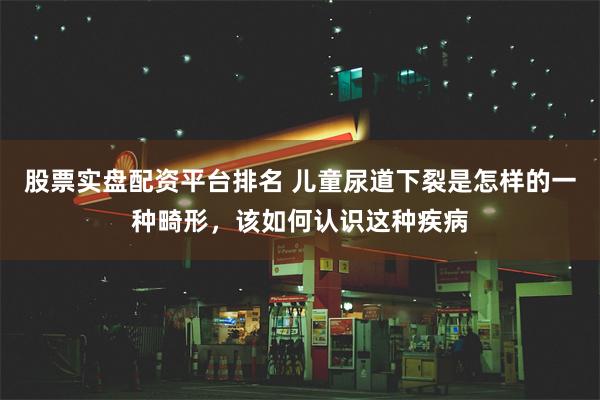 股票实盘配资平台排名 儿童尿道下裂是怎样的一种畸形，该如何认识这种疾病